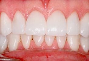 Simonetti and Domozych DDS, PC | Teeth Whitening, Preventative Program and Veneers